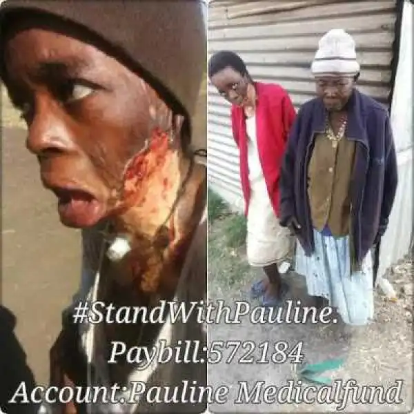 unbelievable, devilish husband set wife on fire [details]